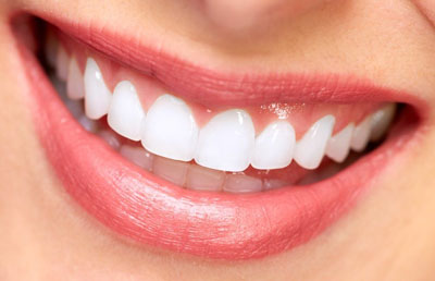 Teeth whitening in Vaughan